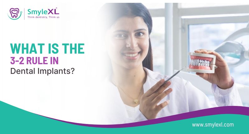 What Is the 3-2 Rule in Dental Implants?