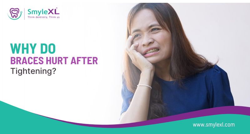 Why Do Braces Hurt After Tightening?