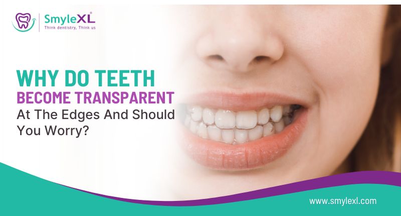 Why Do Teeth Become Transparent at the Edges, and Should You Worry?