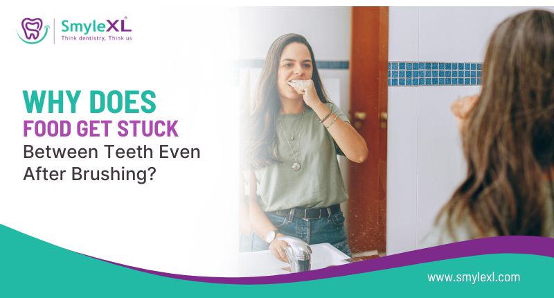 Why Does Food Get Stuck Between Teeth Even After Brushing?