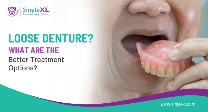 Loose Dentures? What Are the Better Treatment Options