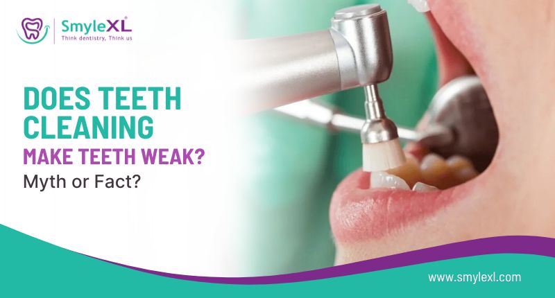 Does Teeth Cleaning Make Teeth Weak? Myth or Fact?