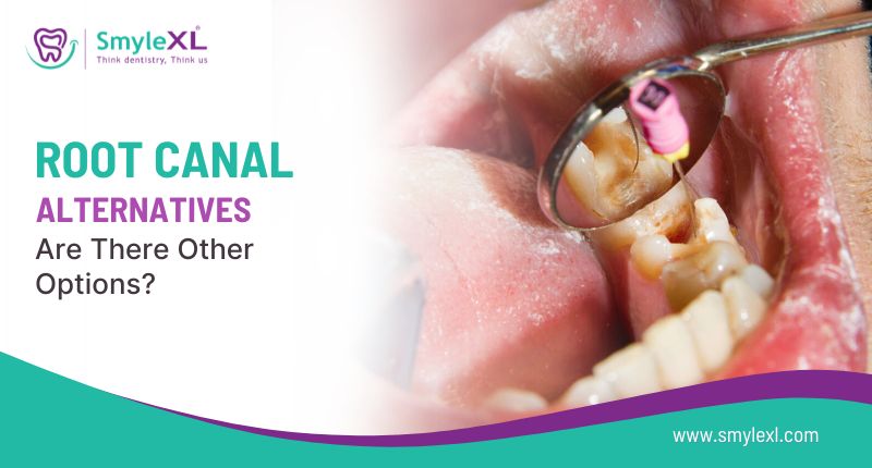 Root Canal Alternatives: Are There Other Options?