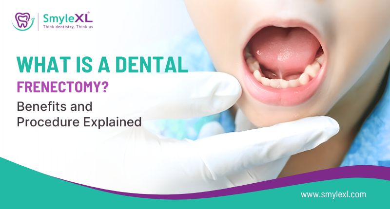 What Is a Dental Frenectomy? Benefits and Procedure Explained
