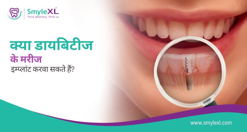 क्या डायबिटीज के मरीज इम्प्लांट करवा सकते हैं?