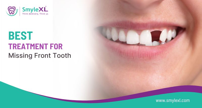 Best Treatment for a Missing Front Tooth