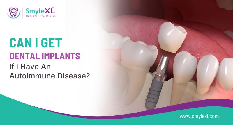 Can I Get Dental Implants if I Have an Autoimmune Disease?