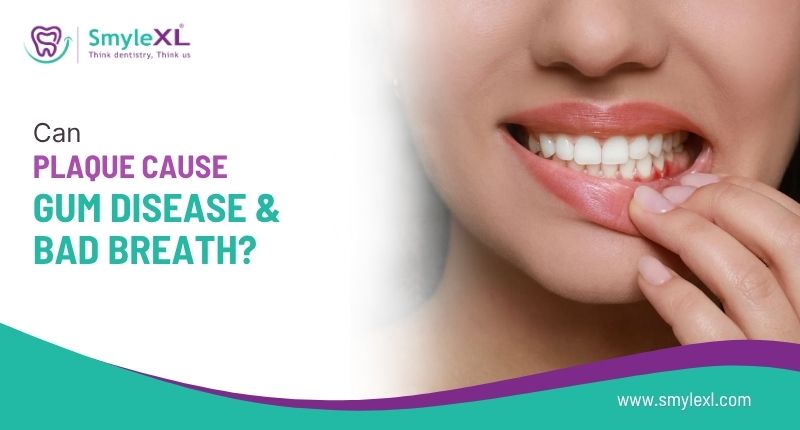 Can Plaque Cause Gum Disease and Bad Breath?