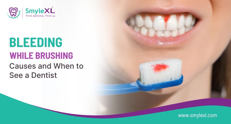 Bleeding While Brushing: Causes and When to See a Dentist