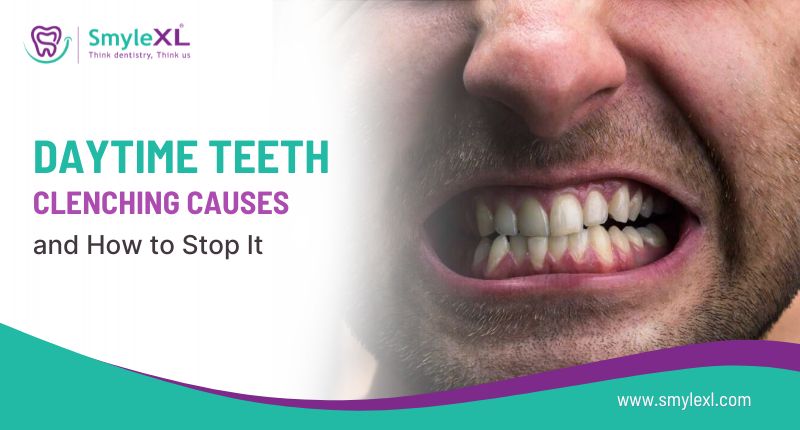 Daytime Teeth Clenching Causes and How to Stop It