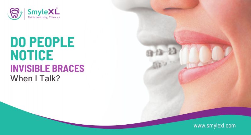Do People Notice Invisible Braces When I Talk?
