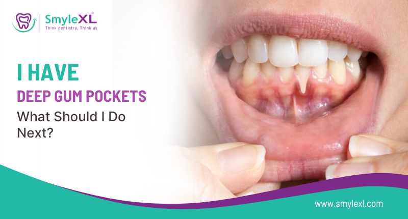 I Have Deep Gum Pockets. What Should I Do Next?
