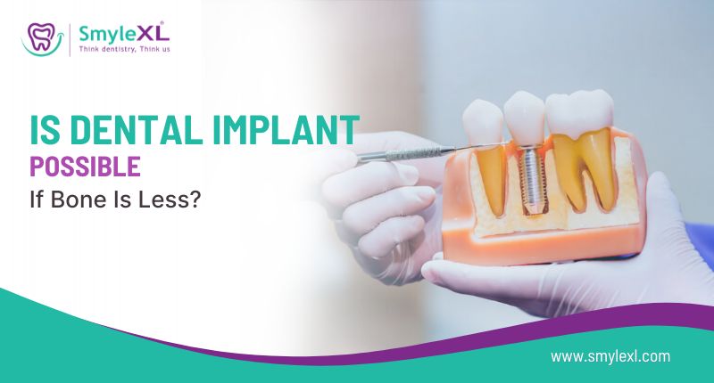 Is Dental Implant Possible If Bone Is Less?