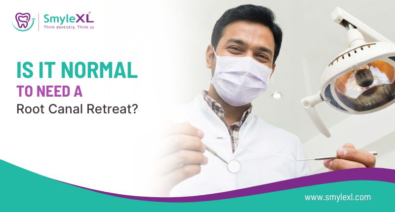 Is It Normal to Need a Root Canal Retreat?
