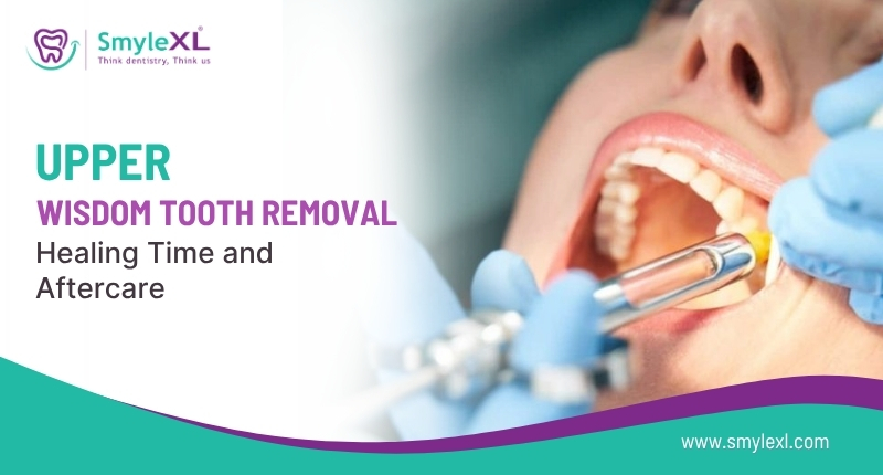 Upper Wisdom Tooth Removal Healing Time and Aftercare