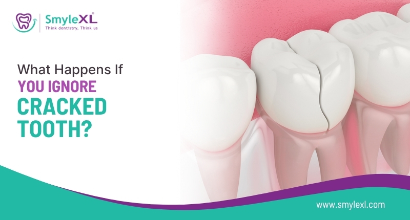 What Happens If You Ignore a Cracked Tooth?