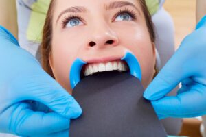 whitening