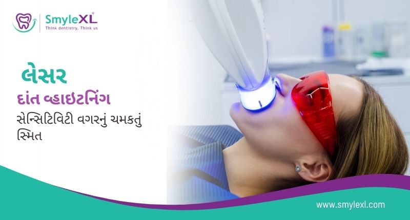 લેસર દાંત વ્હાઇટનિંગ – સેન્સિટિવિટી વગરનું ચમકતું સ્મિત?
