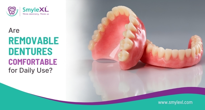 Are Removable Dentures Comfortable for Daily Use?