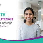 Are Teeth Perfectly Straight After Invisible Braces?