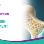 Bone Resorption Causes, Prevention, and Treatment
