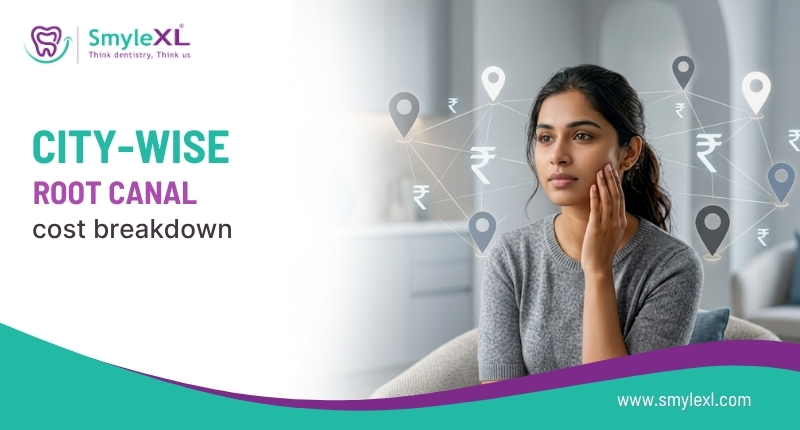 City-Wise Root Canal Cost Breakdown