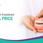Denture Cost Explained: Types and Price Factors