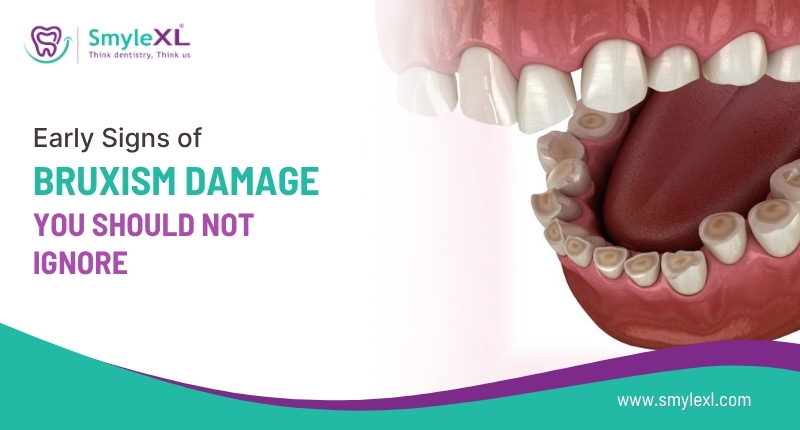 Early Signs of Bruxism Damage You Should Not Ignore