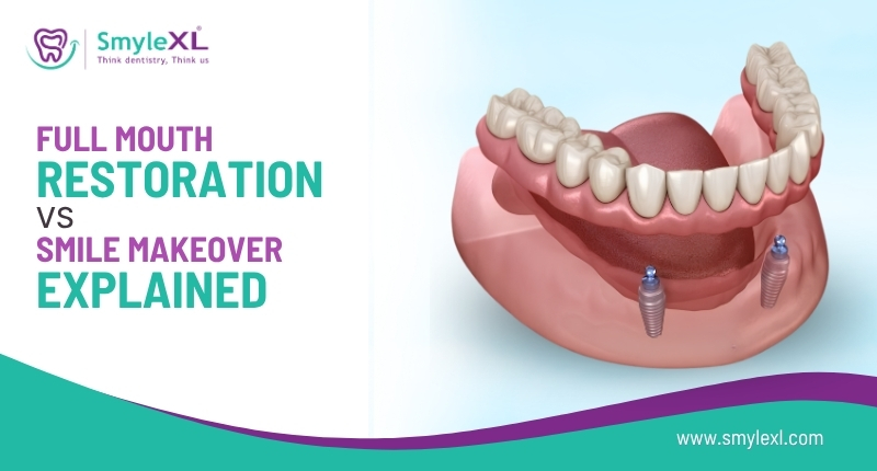 Full Mouth Restoration vs Smile Makeover Explained
