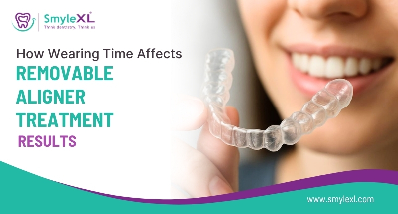 How Wearing Time Affects Removable Aligner Treatment Results