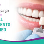 How Celebrities Get White Teeth: The Real Treatments Explained