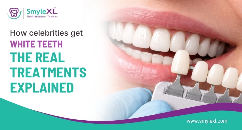 How Celebrities Get White Teeth: The Real Treatments Explained
