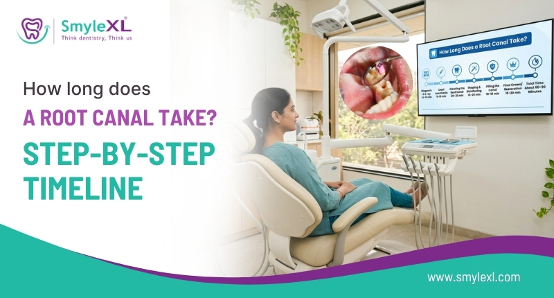 How long does a root canal take? Step-by-step timeline