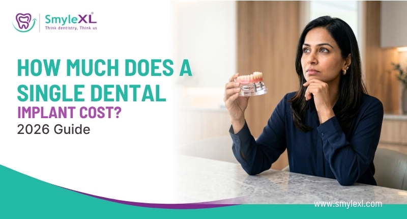 How Much Does a Single Dental Implant Cost? (2026 Guide)