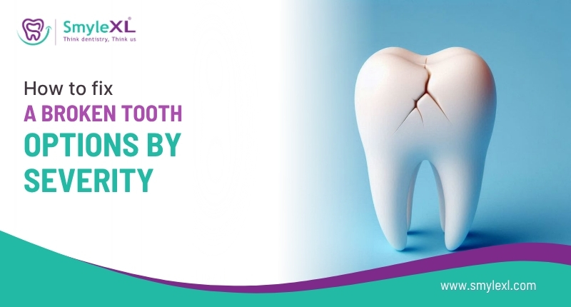 How to Fix a Broken Tooth: Options by Severity