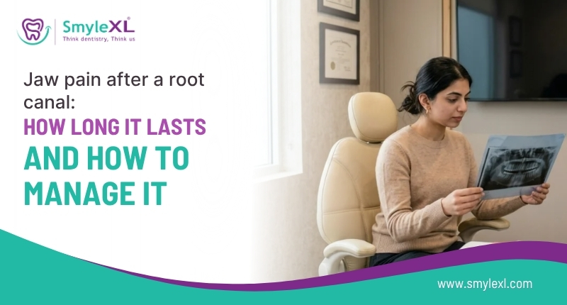 Jaw Pain After a Root Canal: How Long it Lasts and How to Manage it?