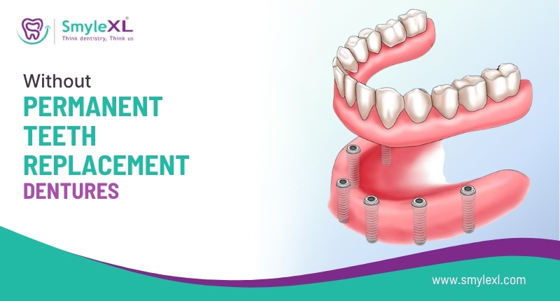 Permanent Teeth Replacement Without Dentures