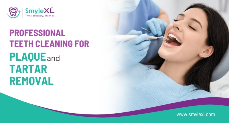 Professional Teeth Cleaning for Plaque and Tartar Removal