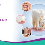 Signs Your Teeth May Lack Calcium!