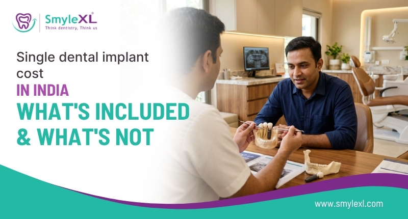 Single Dental Implant Cost in India: What’s Included and What’s Not