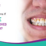 What Happens If Plaque Is Not Removed from Teeth?