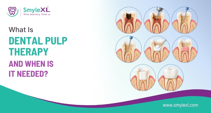 What Is Dental Pulp Therapy and When Is It Needed?