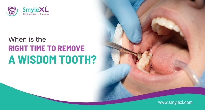 When Is the Right Time to Remove a Wisdom Tooth?