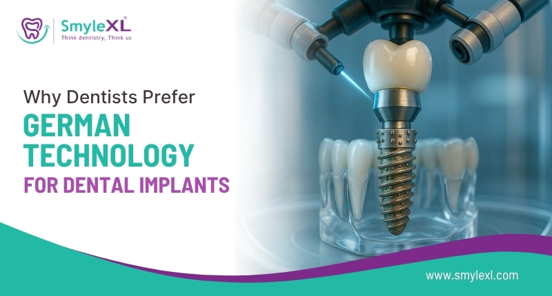 Why Dentists Prefer German Technology for Dental Implants?