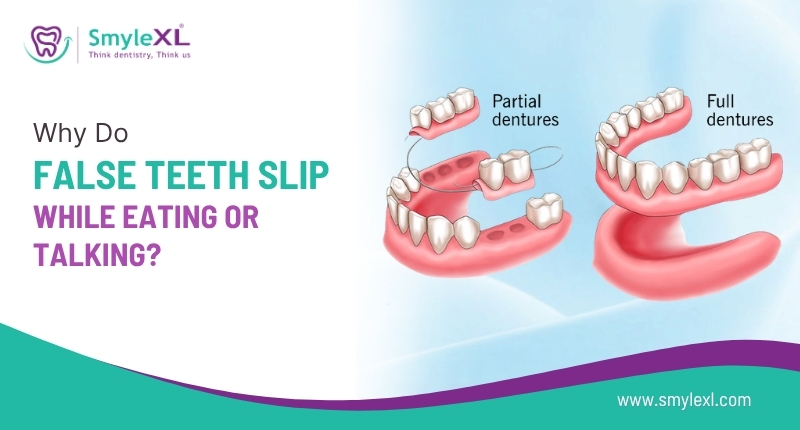 Why Do False Teeth Slip While Eating or Talking?