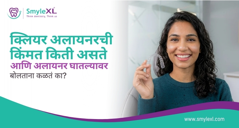 क्लियर अलायनरची किंमत किती असते आणि अलायनर घातल्यावर बोलताना कळतं का?