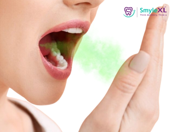 Bad Breath Treatment in Salisbury Park
