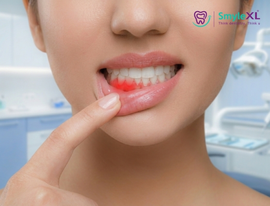 Gum Treatment in Salisbury Park