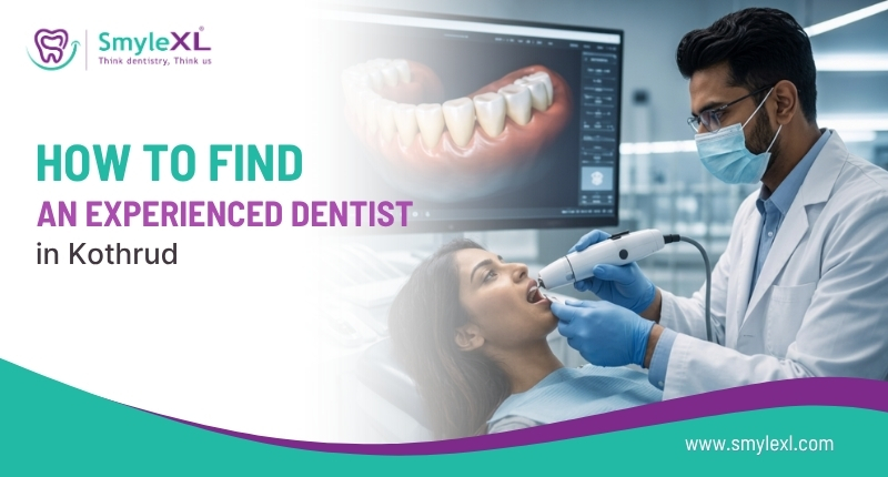 How to Find an Experienced Dentist in Kothrud?
