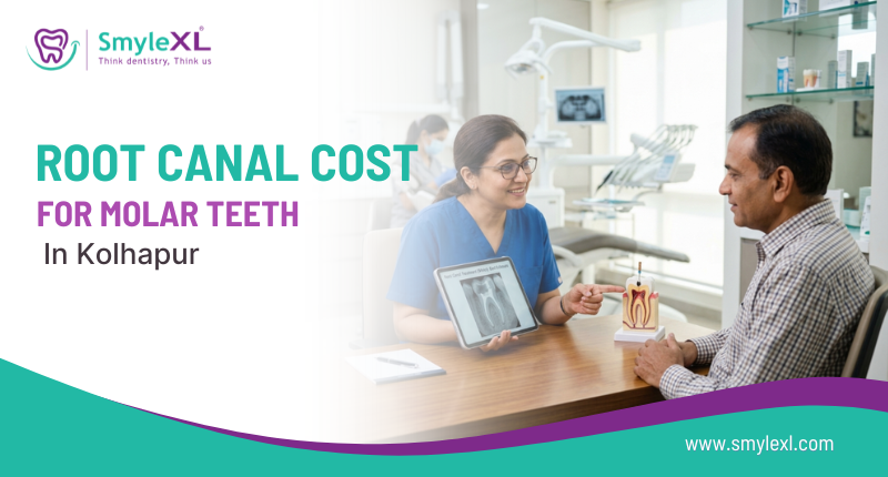Root Canal Cost for Molar Teeth in Kolhapur: What You Need to Know